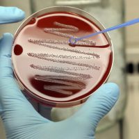 Учёные нашли способ победить супербактерии на МКС