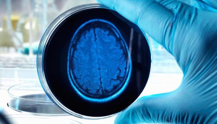 Эксперты предупреждают, что мы «очень близки» к созданию разумных органоидов мозга