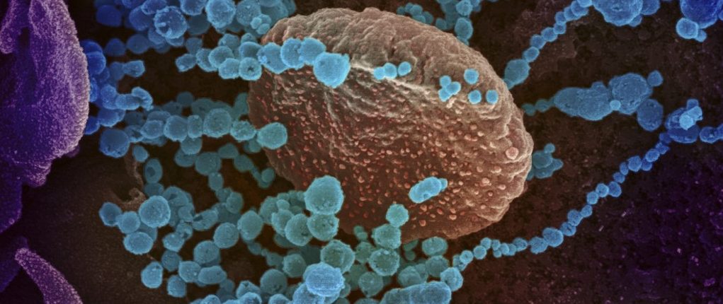 Ученые увидели, как наша иммунная система борется с коронавирусом