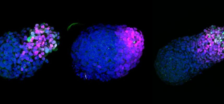 Потрясающая модель человеческого эмбриона из стволовых клеток раскрывает невиданные этапы нашего развития